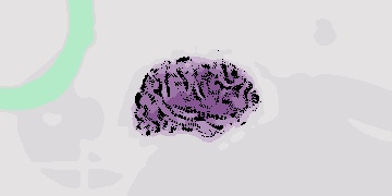 Estudos genéticos utilizam IA para identificar conexões entre genes e doenças, mas isso pode introduzir erros